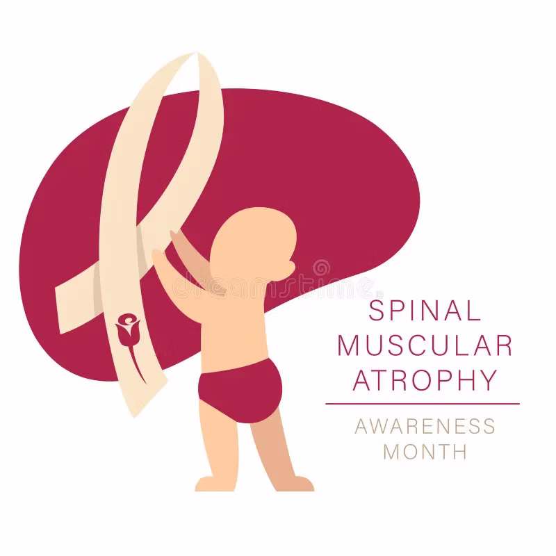 Spinal Muscular Atrophy Treatment Breakthrough Guide