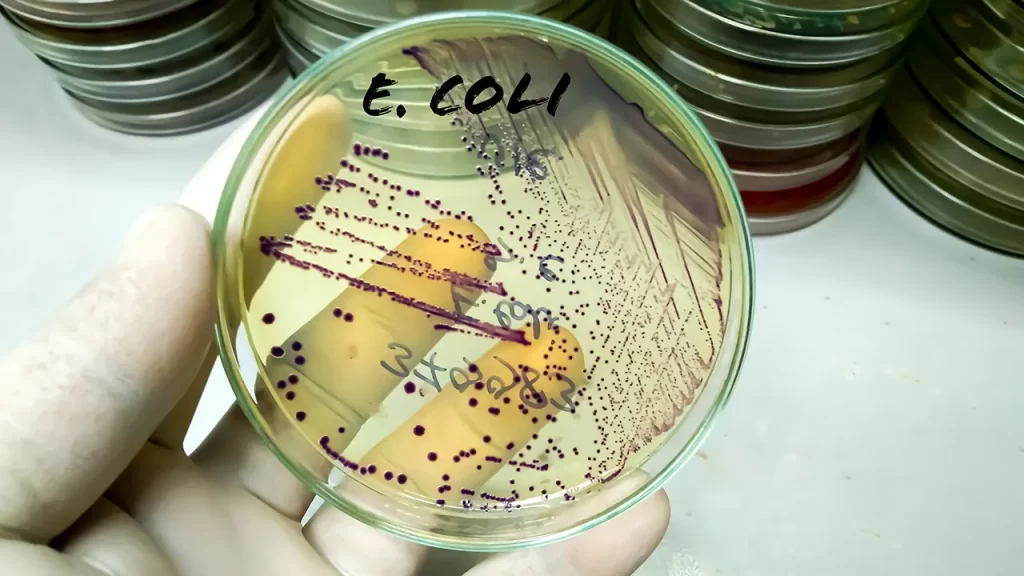 Indiana University researcher sentenced for smuggling E. coli into US